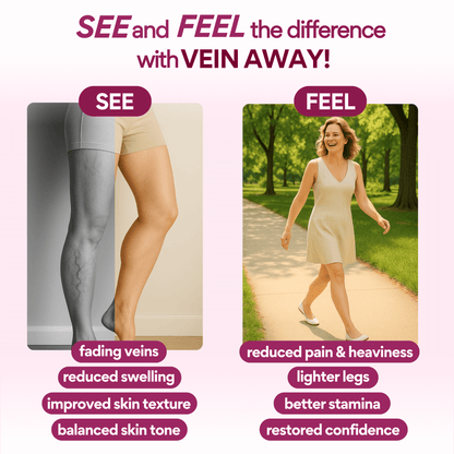 Vein Away